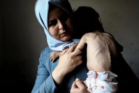 الصحة العالمية: وثقنا ۳۲ وفاة بغزة نتيجة سوء التغذية