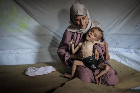 “اليونيسيف”: أطفال غزة يموتون بمعدل غير مسبوق
